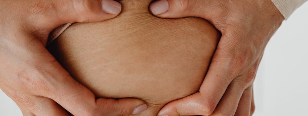 Top Essential Oils to Reduce the Appearance of Stretch Marks