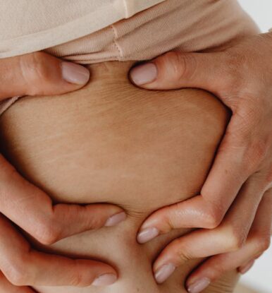 Top Essential Oils to Reduce the Appearance of Stretch Marks